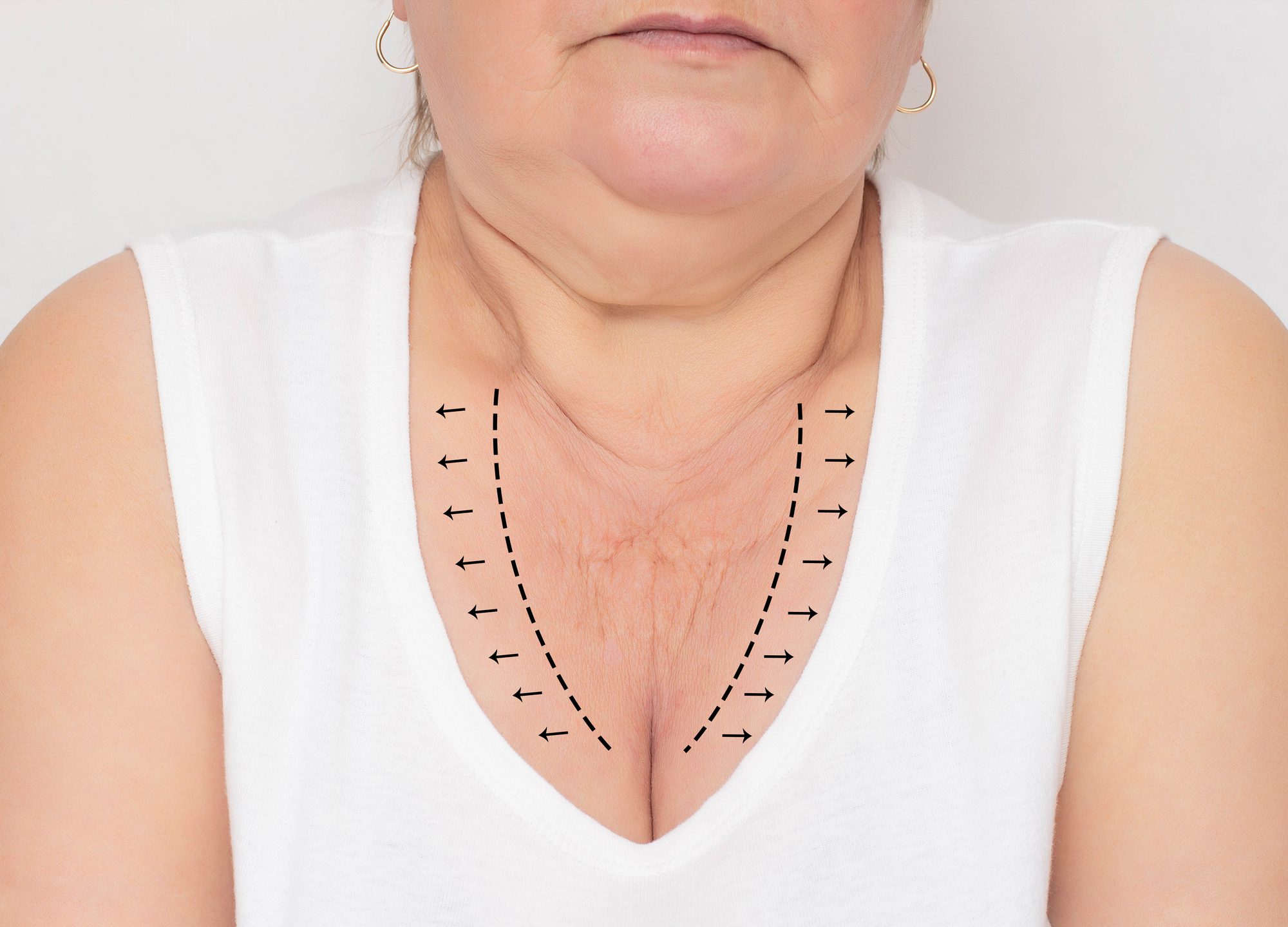 кожа на груди у женщин фото 10